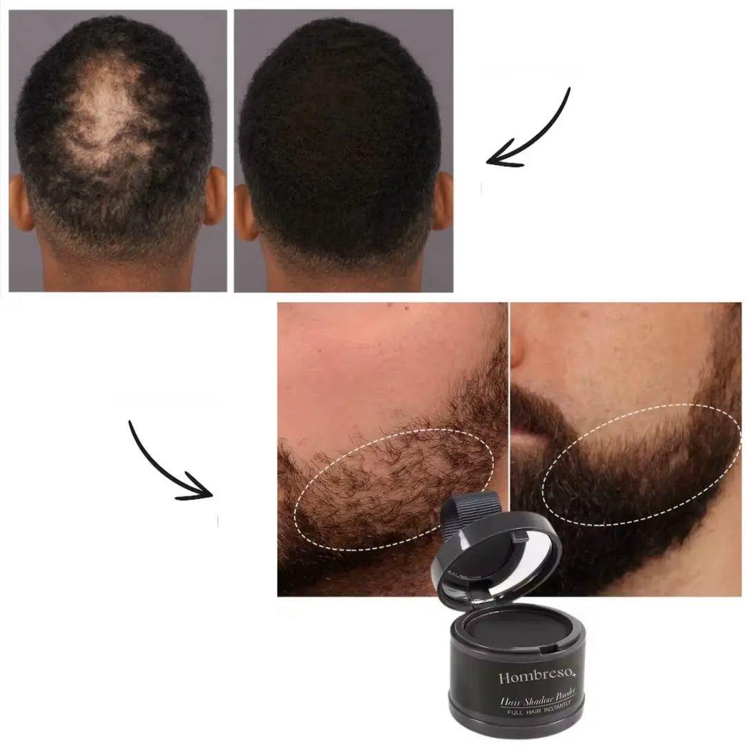 Hair Shadow – Cover Thinning Areas Instantly